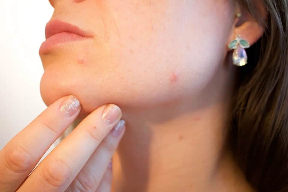 How to recover from skin infections