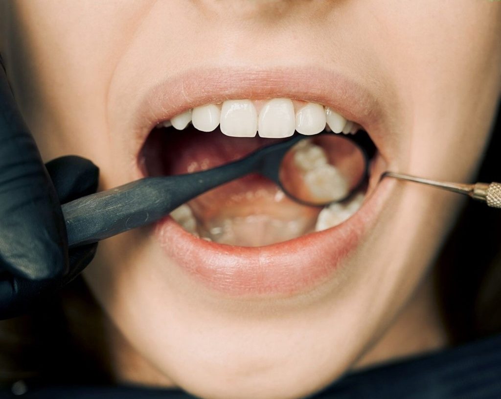 Tips for Better Oral Health
