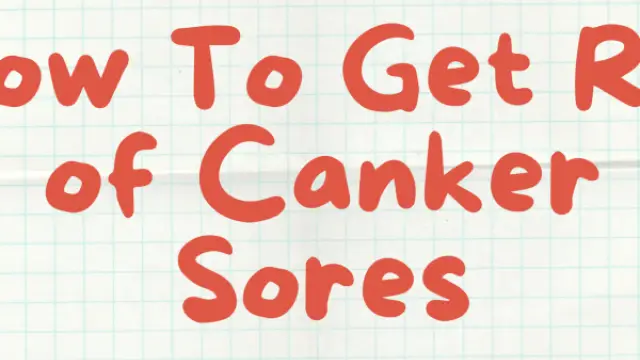 How To Get Rid Of Canker Sores In 24 Hours
