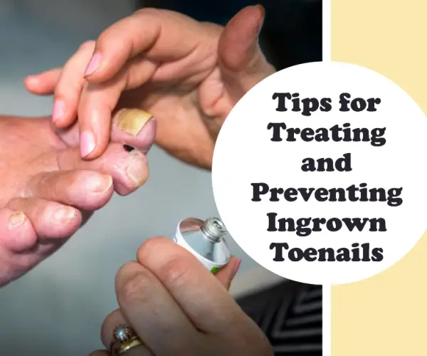 tips for treating ingrown toenails